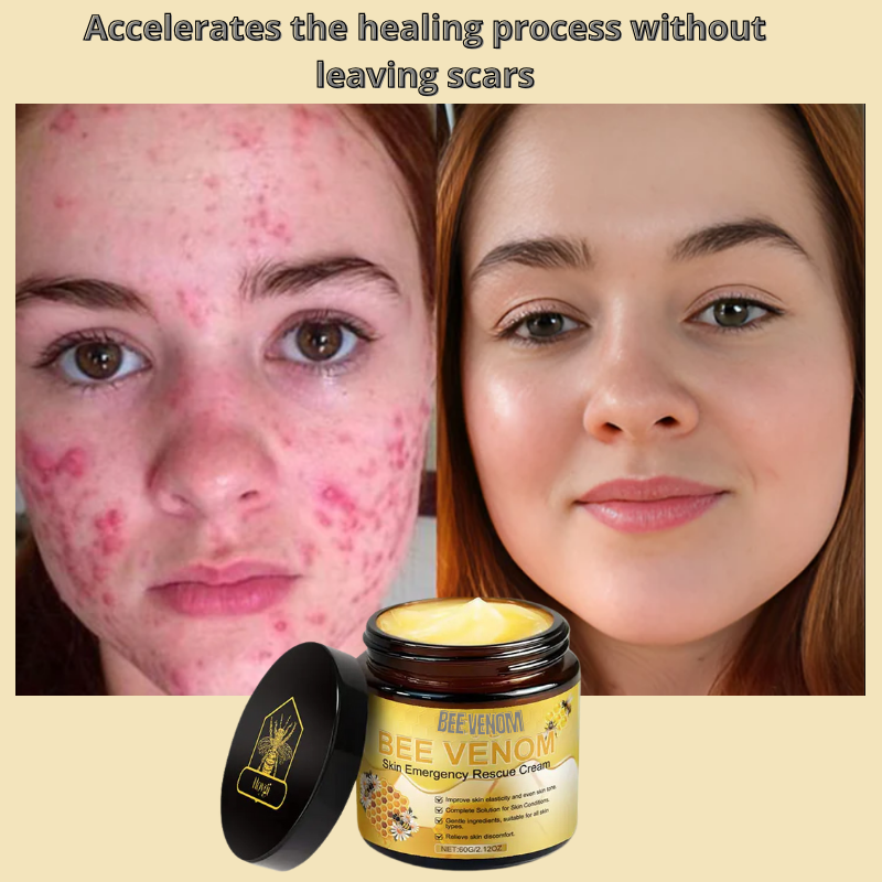 Bee Venom Skin Treatment Cream