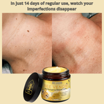 Load image into Gallery viewer, Bee Venom Skin Treatment Cream
