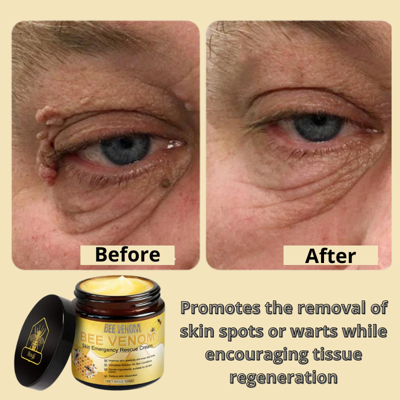 Bee Venom Skin Treatment Cream